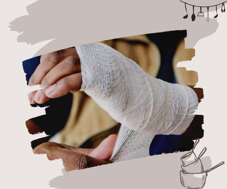 How to Treat a Burn on Hand From Hot Pan Symptoms, First Aid and